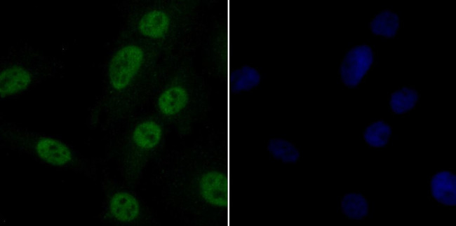 GPR30 Antibody in Immunocytochemistry (ICC/IF)