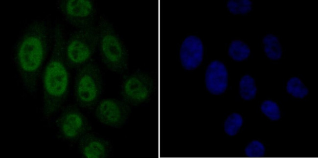 GPR30 Antibody in Immunocytochemistry (ICC/IF)