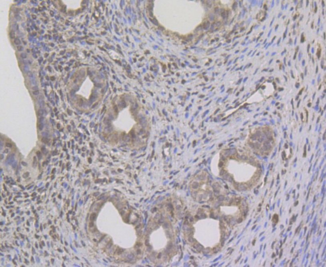 GPR30 Antibody in Immunohistochemistry (Paraffin) (IHC (P))