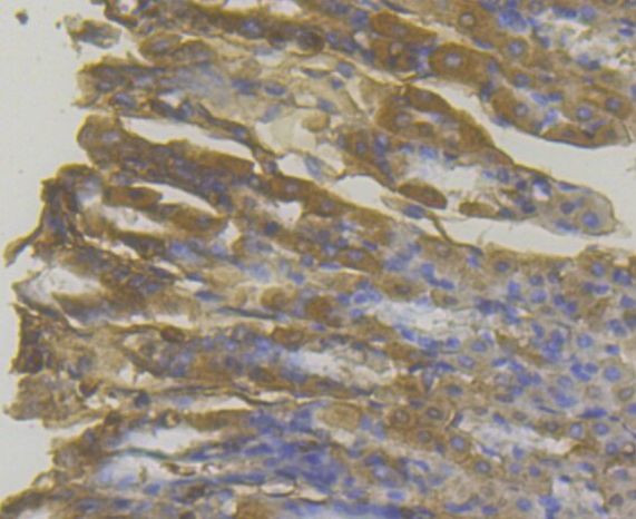 MICA/B Antibody in Immunohistochemistry (Paraffin) (IHC (P))