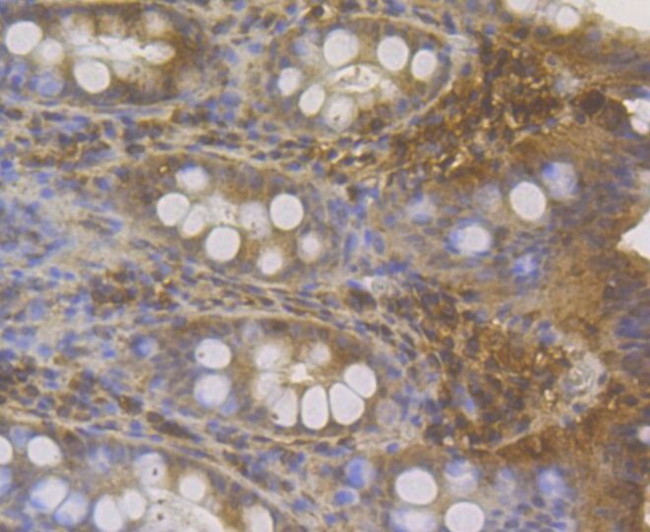 MICA/B Antibody in Immunohistochemistry (Paraffin) (IHC (P))