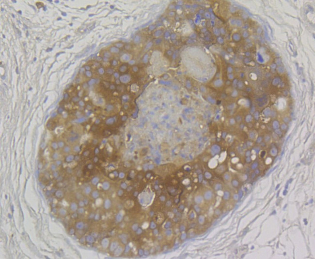 MICA/B Antibody in Immunohistochemistry (Paraffin) (IHC (P))