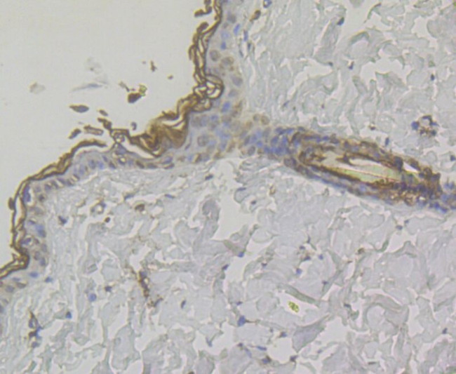 MICA/B Antibody in Immunohistochemistry (Paraffin) (IHC (P))