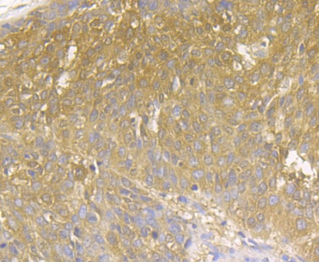 MICA/B Antibody in Immunohistochemistry (Paraffin) (IHC (P))