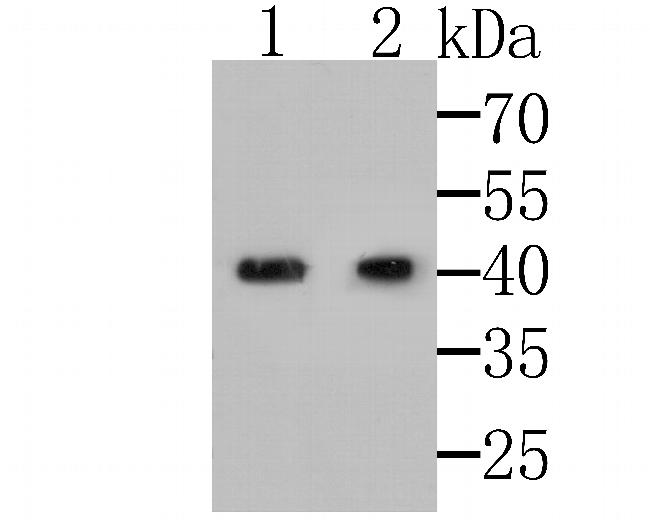 MICA/B Antibody in Western Blot (WB)