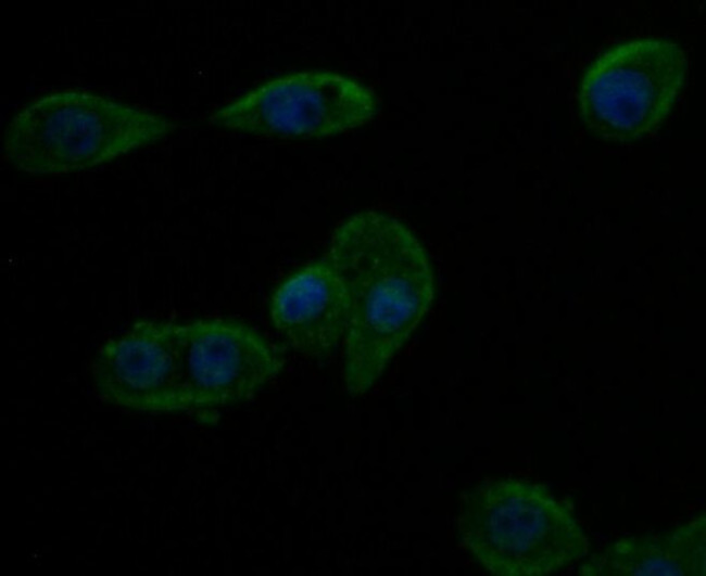 Kir6.2 (KCNJ11) Antibody in Immunocytochemistry (ICC/IF)