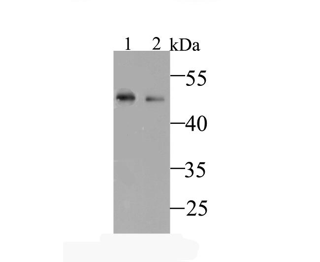 Kir6.2 (KCNJ11) Antibody in Western Blot (WB)