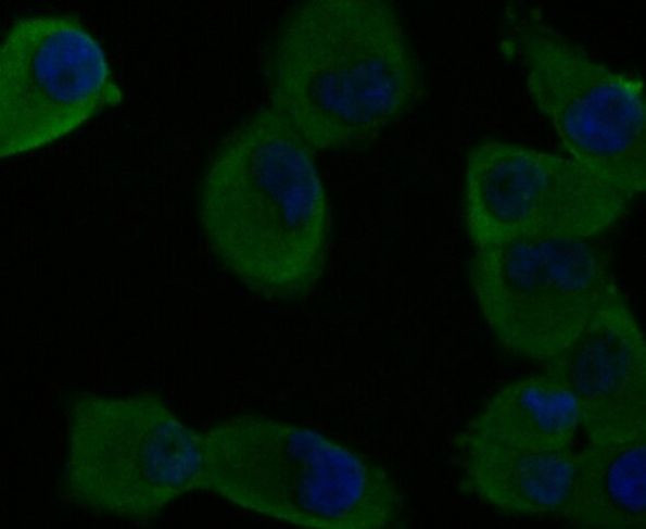 CDH17 Antibody in Immunocytochemistry (ICC/IF)