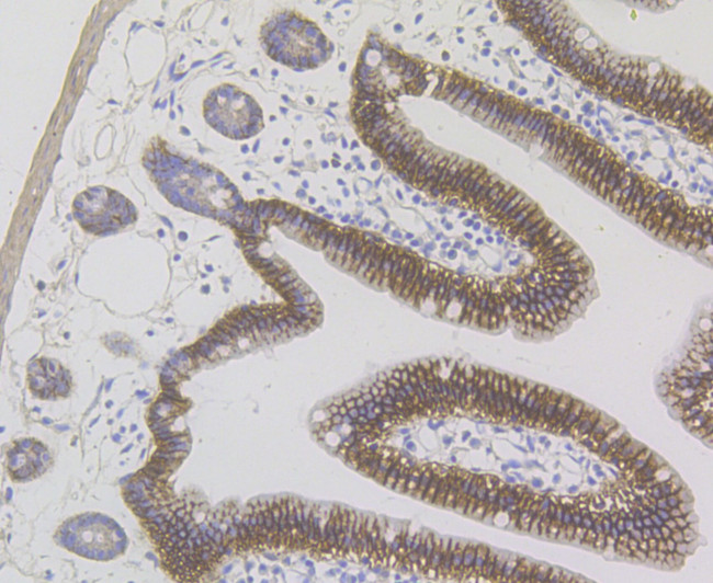 CDH17 Antibody in Immunohistochemistry (Paraffin) (IHC (P))