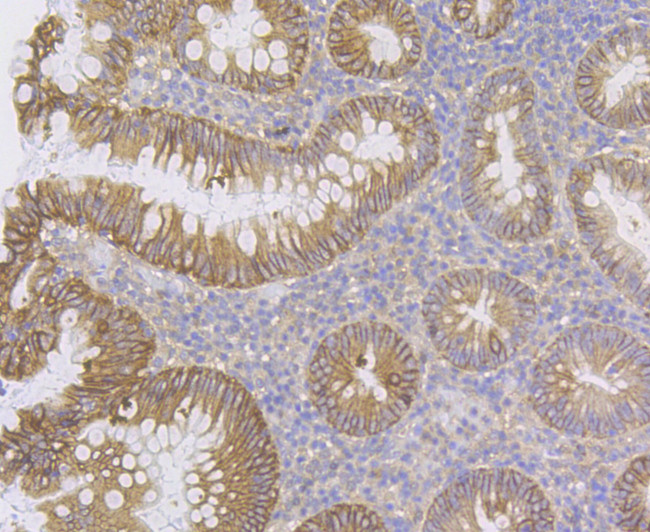 CDH17 Antibody in Immunohistochemistry (Paraffin) (IHC (P))