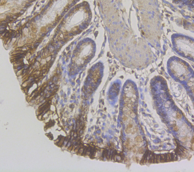 CDH17 Antibody in Immunohistochemistry (Paraffin) (IHC (P))