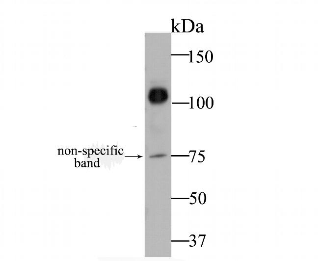 CDH17 Antibody in Western Blot (WB)