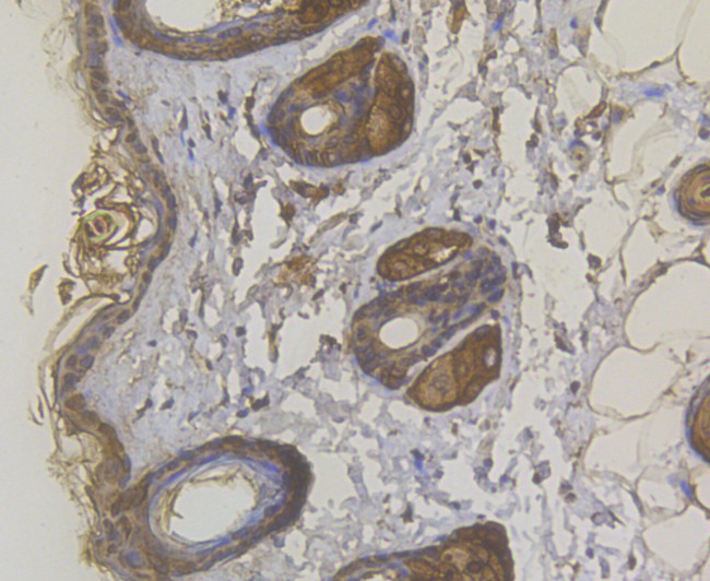 Cytokeratin 5 Antibody in Immunohistochemistry (Paraffin) (IHC (P))