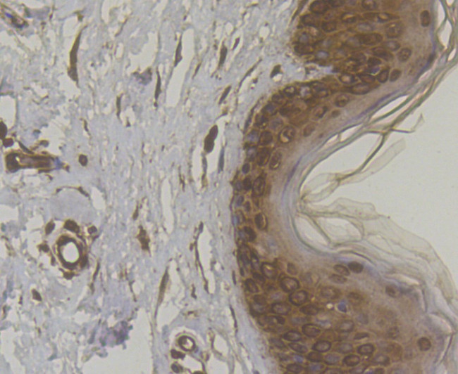 Cytokeratin 5 Antibody in Immunohistochemistry (Paraffin) (IHC (P))