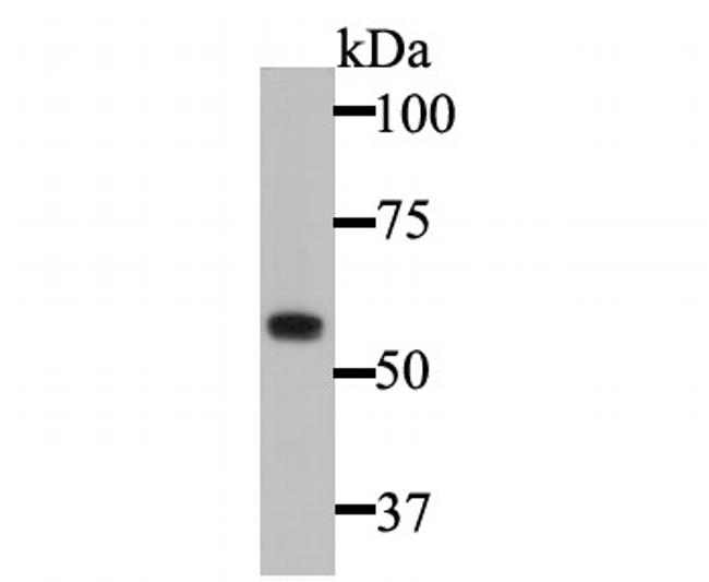 Cytokeratin 5 Antibody in Western Blot (WB)