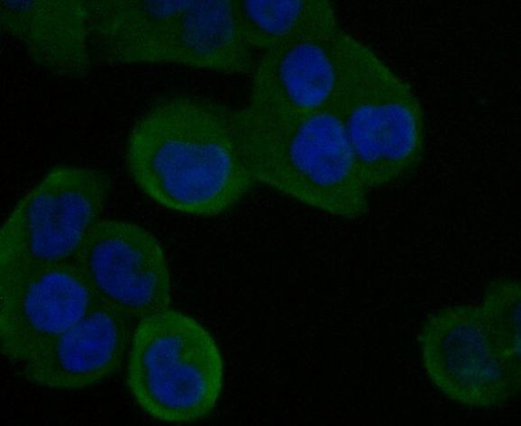 STIM2 Antibody in Immunocytochemistry (ICC/IF)