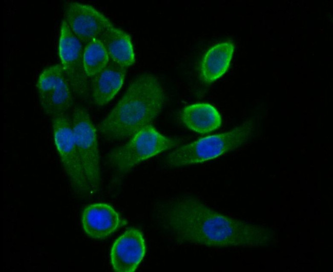 STIM2 Antibody in Immunocytochemistry (ICC/IF)