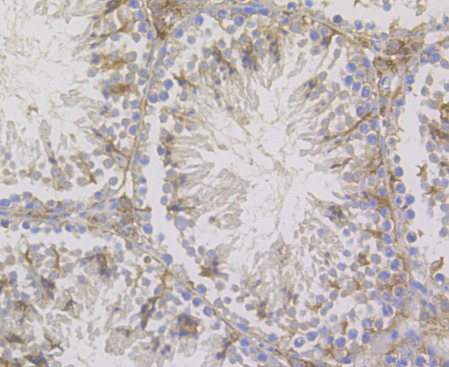 STIM2 Antibody in Immunohistochemistry (Paraffin) (IHC (P))