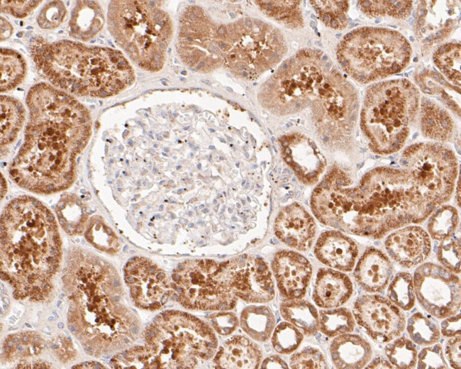 ACADL Antibody in Immunohistochemistry (Paraffin) (IHC (P))