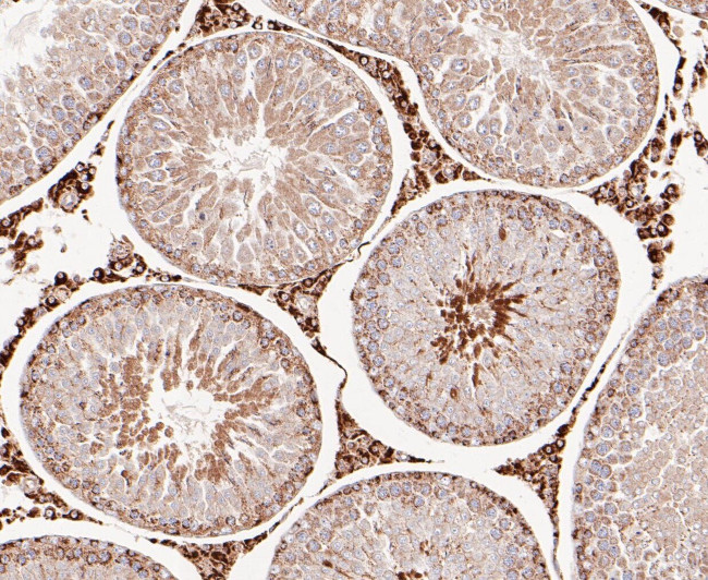 DFNA5 Antibody in Immunohistochemistry (Paraffin) (IHC (P))