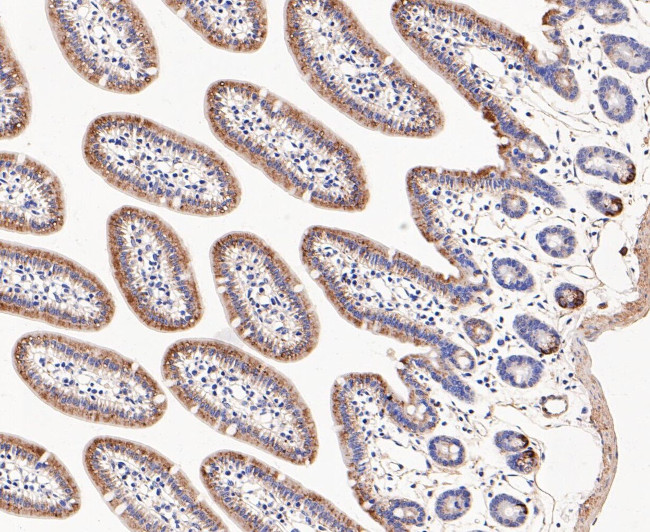 DFNA5 Antibody in Immunohistochemistry (Paraffin) (IHC (P))