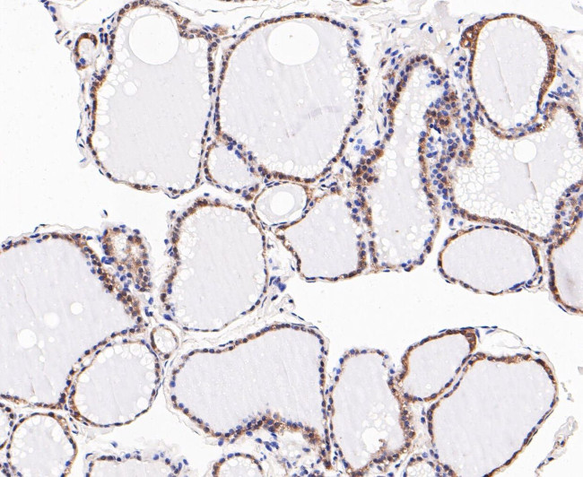 DFNA5 Antibody in Immunohistochemistry (Paraffin) (IHC (P))