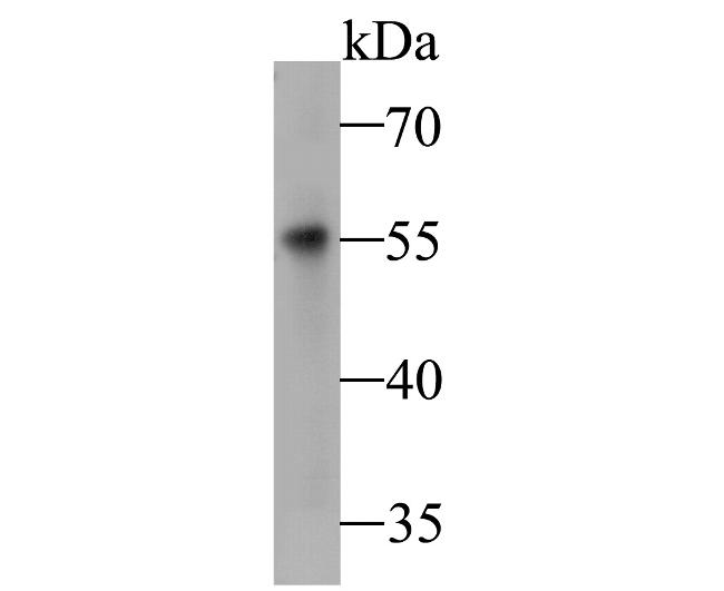 DFNA5 Antibody in Western Blot (WB)