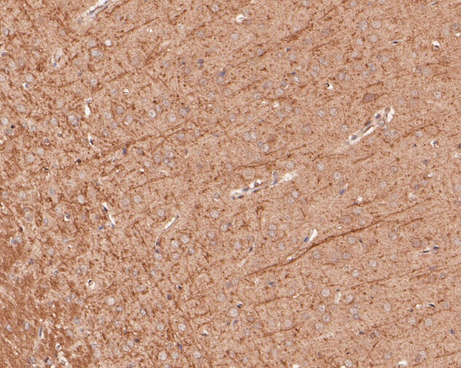 B3GAT1 Antibody in Immunohistochemistry (Paraffin) (IHC (P))