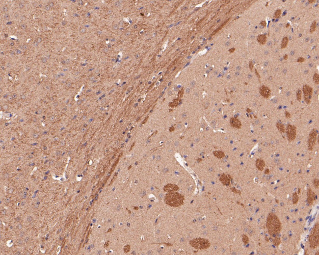 B3GAT1 Antibody in Immunohistochemistry (Paraffin) (IHC (P))