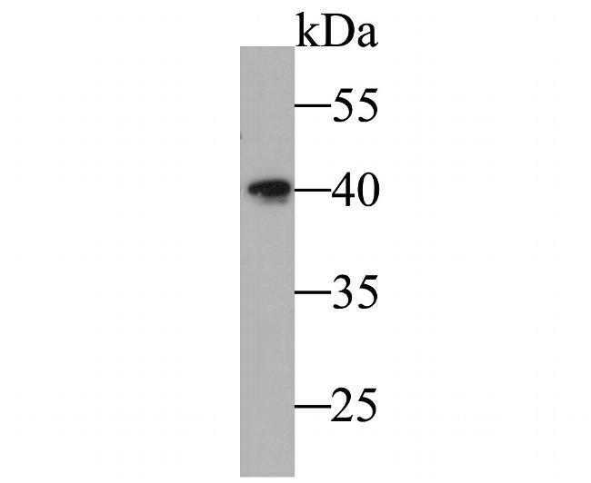 B3GAT1 Antibody in Western Blot (WB)