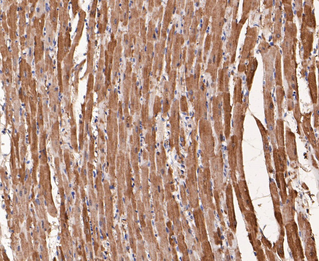 Myoglobin Antibody in Immunohistochemistry (Paraffin) (IHC (P))