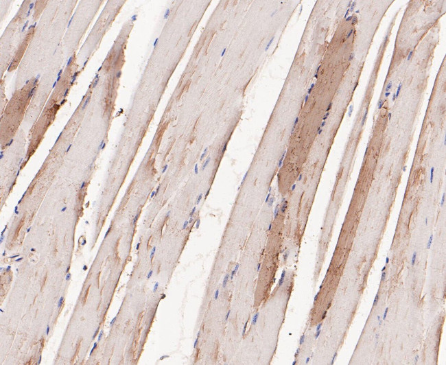 Myoglobin Antibody in Immunohistochemistry (Paraffin) (IHC (P))