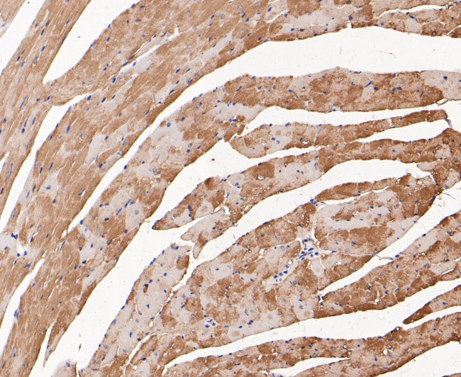 Myoglobin Antibody in Immunohistochemistry (Paraffin) (IHC (P))