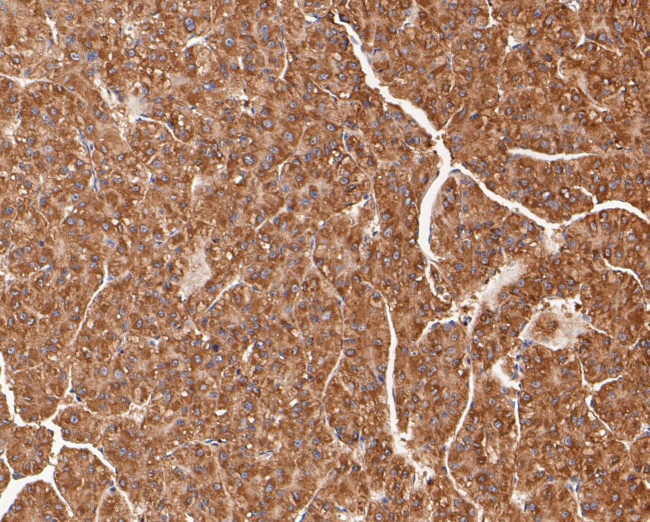 TRPML3 Antibody in Immunohistochemistry (Paraffin) (IHC (P))