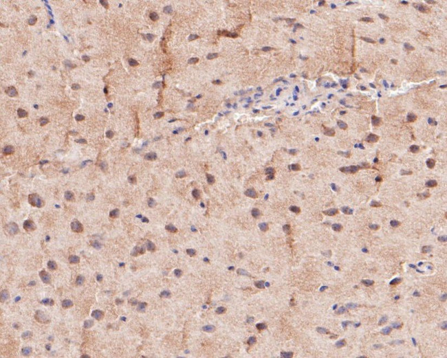 KV1.1 (KCNA1) Antibody in Immunohistochemistry (Paraffin) (IHC (P))