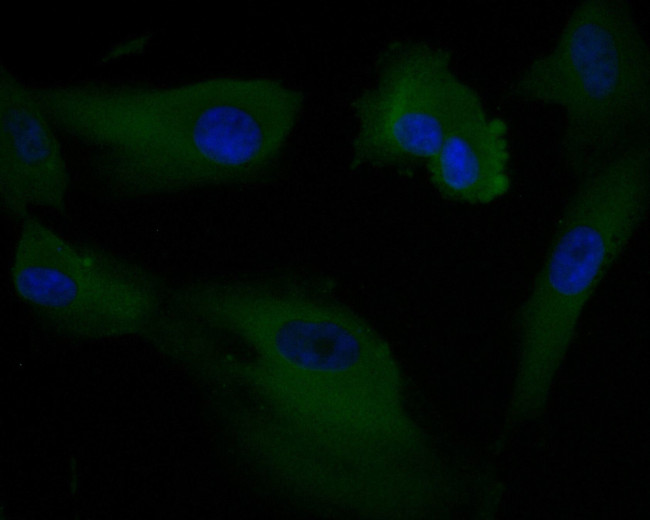 AKT3 Antibody in Immunocytochemistry (ICC/IF)