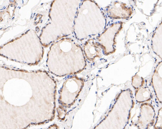 AKT3 Antibody in Immunohistochemistry (Paraffin) (IHC (P))