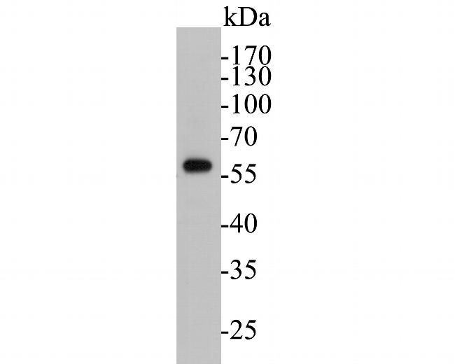 AKT3 Antibody in Western Blot (WB)