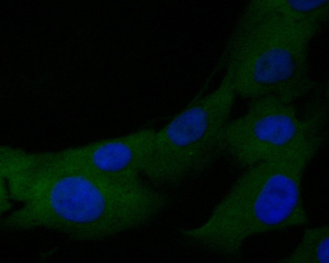 TMX Antibody in Immunocytochemistry (ICC/IF)