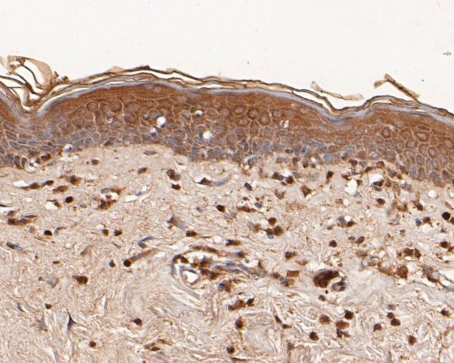 TMX Antibody in Immunohistochemistry (Paraffin) (IHC (P))