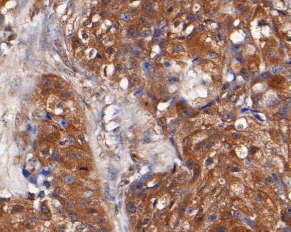 TMX Antibody in Immunohistochemistry (Paraffin) (IHC (P))