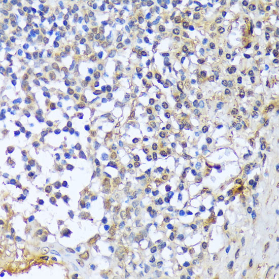 A1CF Antibody in Immunohistochemistry (Paraffin) (IHC (P))