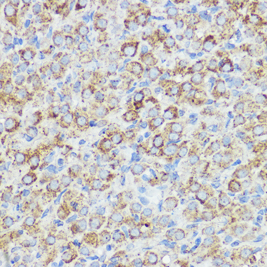 ABI1 Antibody in Immunohistochemistry (Paraffin) (IHC (P))