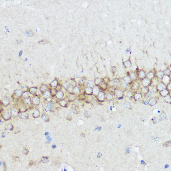 ABI1 Antibody in Immunohistochemistry (Paraffin) (IHC (P))