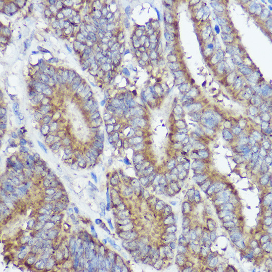 ABI1 Antibody in Immunohistochemistry (Paraffin) (IHC (P))