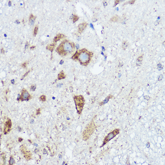 ABI1 Antibody in Immunohistochemistry (Paraffin) (IHC (P))