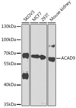 ACAD9 Antibody in Western Blot (WB)