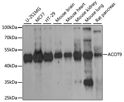 ACOT9 Antibody in Western Blot (WB)