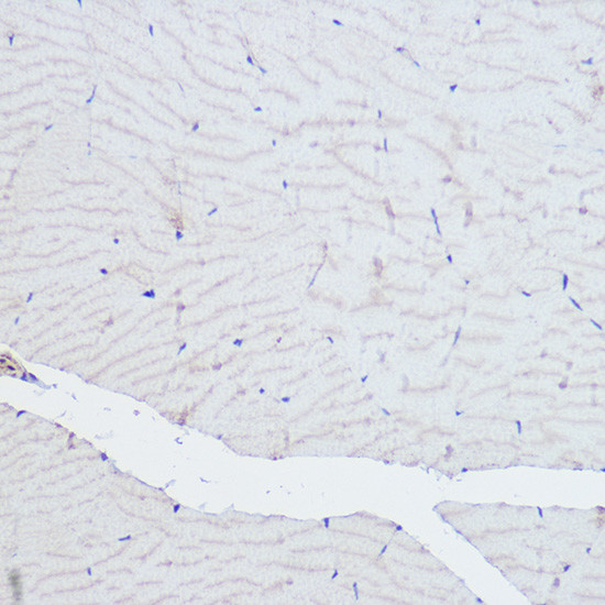 alpha Actinin 3 Antibody in Immunohistochemistry (Paraffin) (IHC (P))