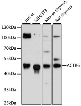 ACTR6 Antibody in Western Blot (WB)